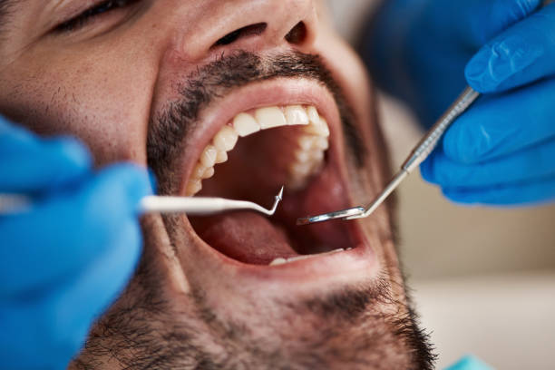 Best Root Canal Emergency Dentist  in Rancho Palos Verdes, CA